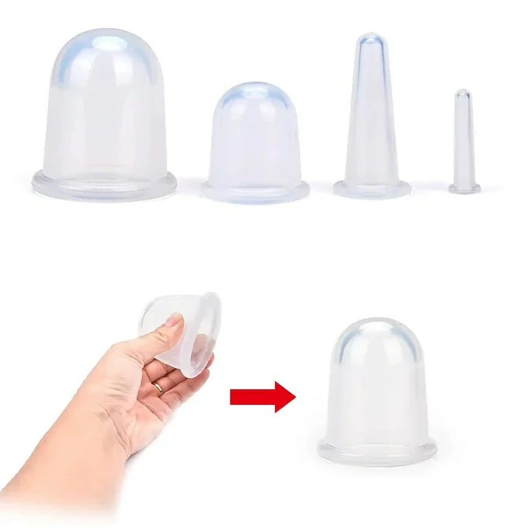 Köpölyterápia zsírcsökkentésre és cellulitisz ellen